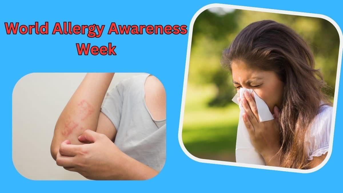 World Allergy Awareness Week