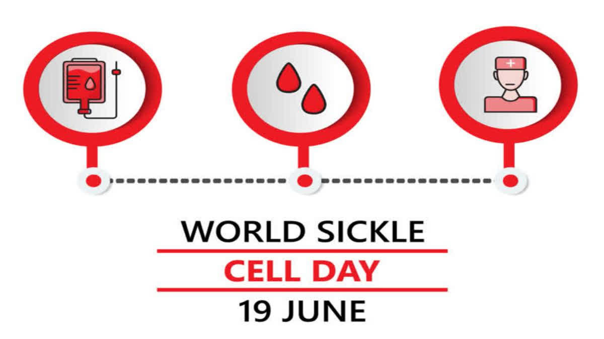 The World Sickle Cell Day is an international awareness day observed every year on June 19 to inform people about sickle cell disease (SCD).