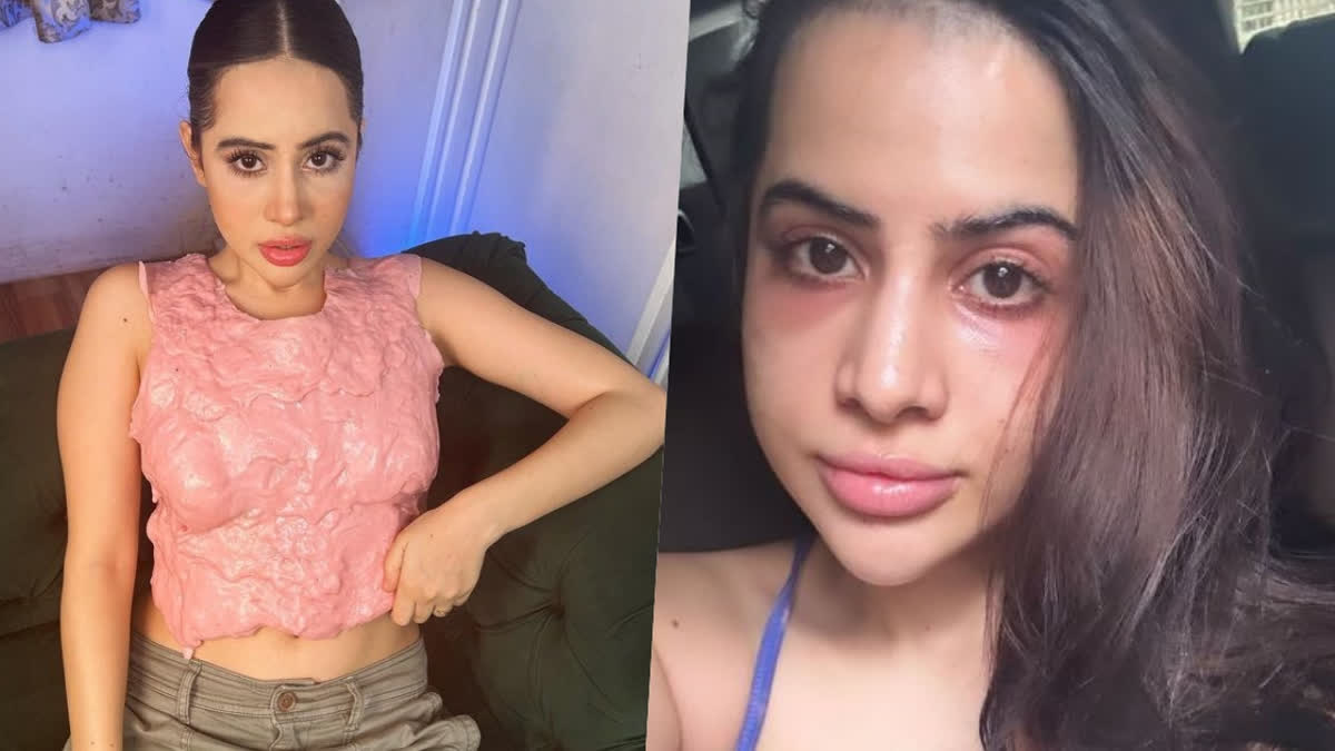 'Got undereye fillers and my face looks very...': Uorfi Javed's cosmetic treatment goes horribly wrong, shares no filter pictures regretting her decision