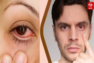 How does eye cancer occur, what are its initial symptoms and treatment