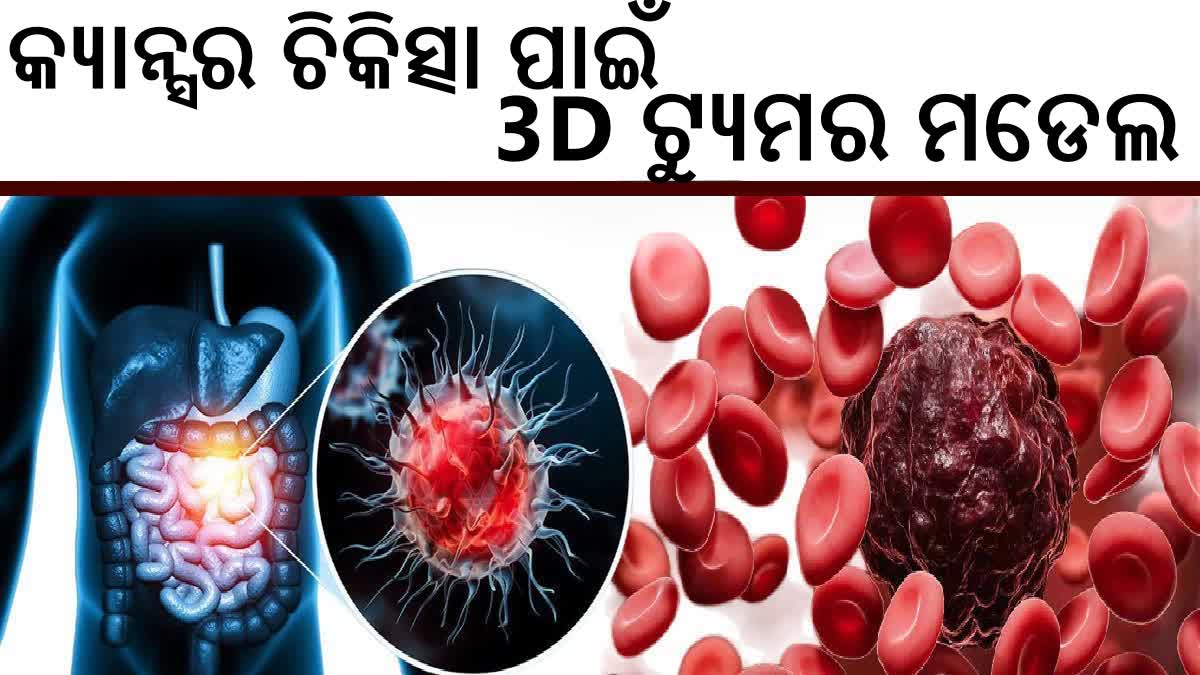 3D tumor models