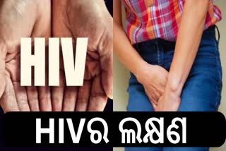 HIV AIDS Symptoms