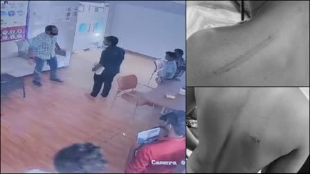 NEET Students Beaten Up At Coaching Centre In Tirunelveli, CCTV Footage Submitted To Cops