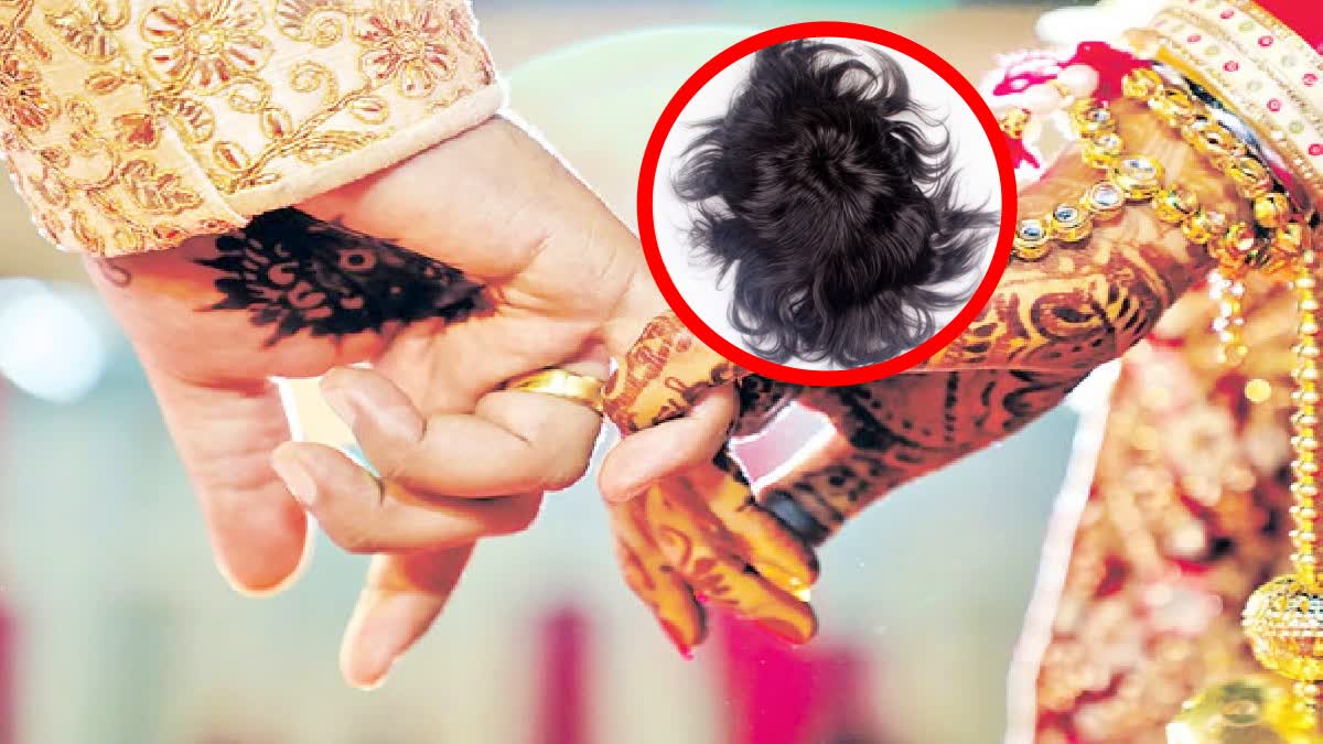 Man Committed Frauds in Name Of Marriage in Hyderabad