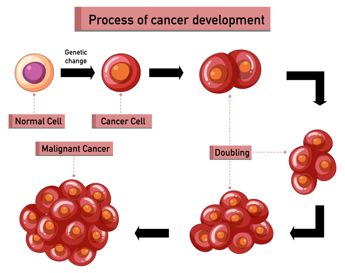 An illustration of cancer development