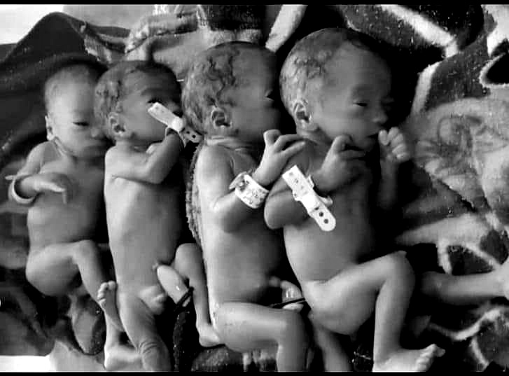 Quadruplets News Latest Assam Today