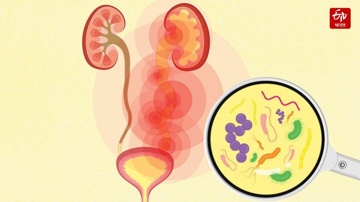 UTI in men can cause problems in kidney or prostate