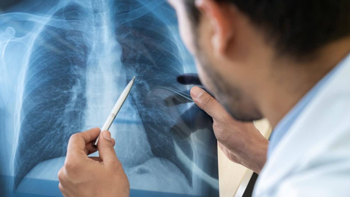 Your Practical Guide To Prevent Lungs Issues During Heatwave