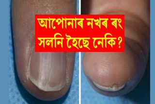 Cancer Symptoms In Nails