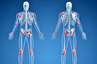 EARLY SYMPTOMS OF ARTHRITIS  DO I HAVE ARTHRITIS EARLY SYMPTOMS  ARTHRITIS SYMPTOMS  ಸಂಧಿವಾತ ಕಾಯಿಲೆ