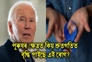 AGGRESSIVE PROSTATE CANCER