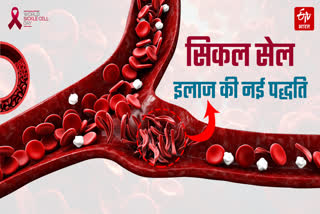 Sickle Cell Anemia Disease