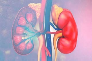 KIDNEY CANCER TREATMENT