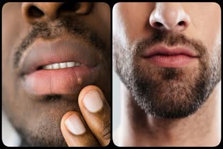 Men Dark Lip Remedies