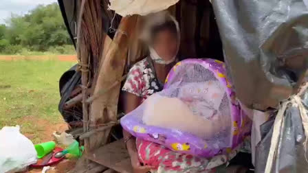 No matter how much society progresses educationally, scientifically or economically, it is a sad thing to know that superstitious belief is still prevalent in some communities. A woman along with her newborn twins has been staying at a hutment to get rid of "negative spells" at a village in Karnataka's Tumakur district .