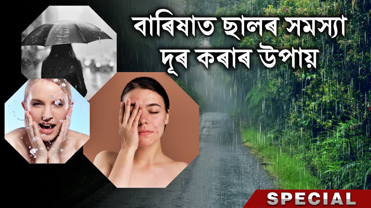 RAINY SEASON PRECAUTIONS SKIN CARE TIPS