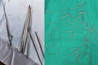 70 Needles In Teenager Head