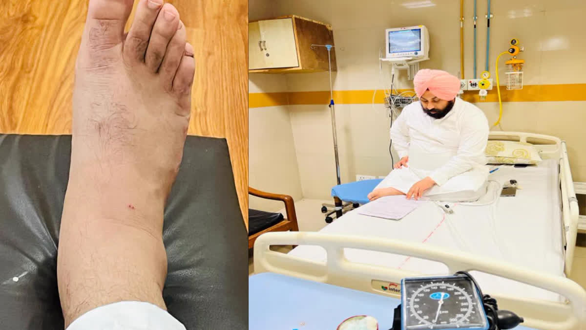 Cabinet Minister Harjot Bains was bitten by a snake