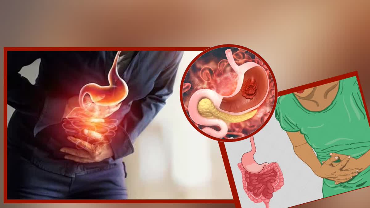 Stomach Gastric Problem