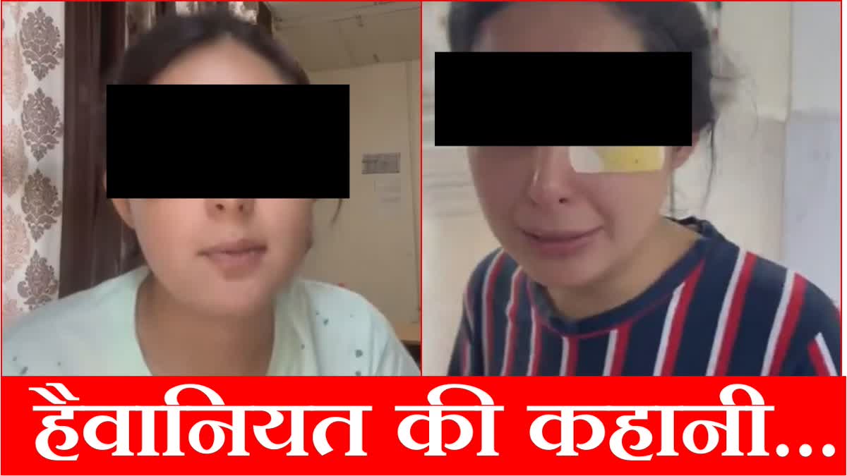 Resident doctor who tortured medical student in Rohtak Haryana expelled and arrested by Police