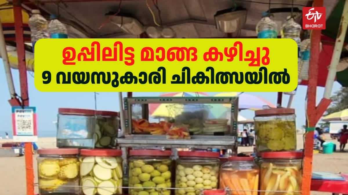 കോഴിക്കോട് കുട്ടിക്ക് ഭക്ഷ്യവിഷബാധ  കോഴിക്കോട് ബീച്ച് ഉപ്പിലിട്ട മാങ്ങ  SALTED MANGO FOOD POISON KOZHIKODE  Kozhikode Beach Salted Mango Shop