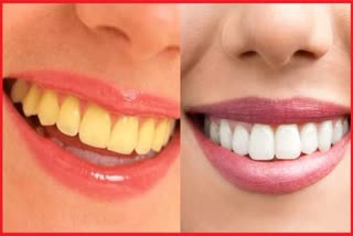 Whiten your teeth naturally