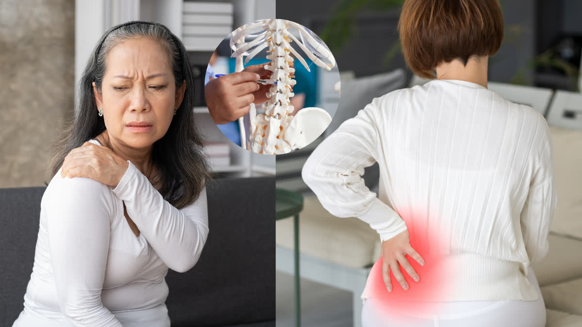 Osteoporosis after Menopause, why celebrated World Osteoporosis Day 2024