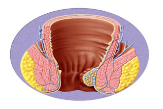 World Piles Day: Raising Awareness About Ailment Of Hemorrhoids