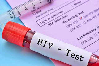 Himachal Pradesh HIV Case