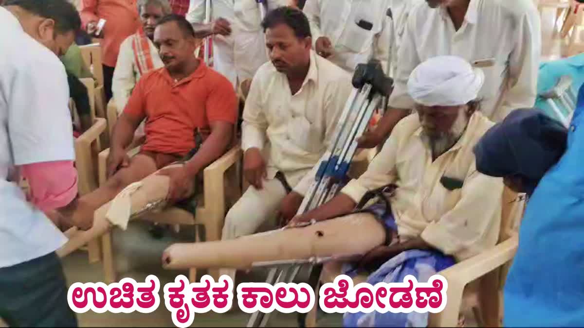 APPLICATIONS INVITED FOR FREE ARTIFICIAL LIMBS FITTING IN BELAGAVI