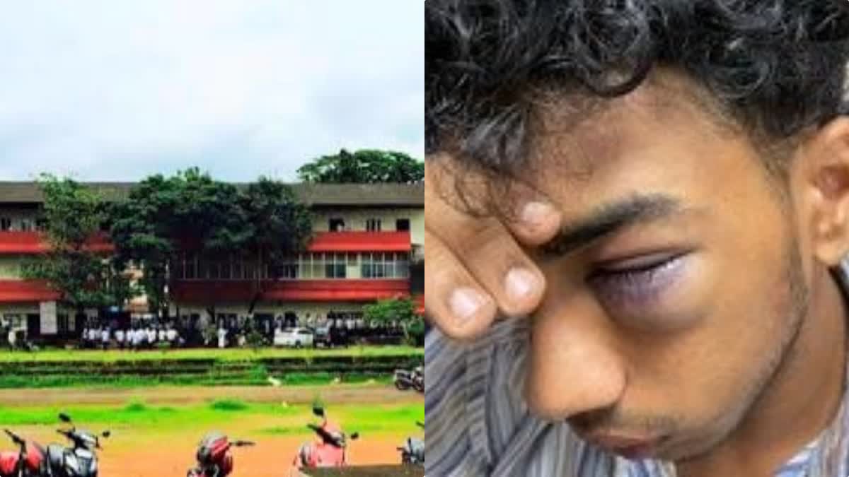 Modi  Junior student injured in ragging  Student injured in Ragging  Chathamangalam in Kozhikode  news updates in Kozhikode  latest news in Kozhikode  വസ്‌ത്ര ധാരണവും ഹെയര്‍ സ്റ്റൈലും  റാഗിങ്  ജൂനിയര്‍ വിദ്യാര്‍ഥിക്ക് ഗുരുതര പരിക്ക്  റാഗിങ്ങില്‍ ജൂനിയര്‍ വിദ്യാര്‍ഥിക്ക് പരിക്ക്  ചാത്തമംഗലം എംഇഎസ് കോളജ്  ഡിഗ്രി വിദ്യാർഥി