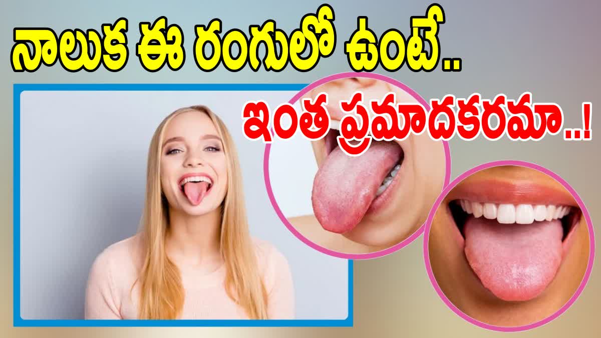 Tounge Tells About Your Health