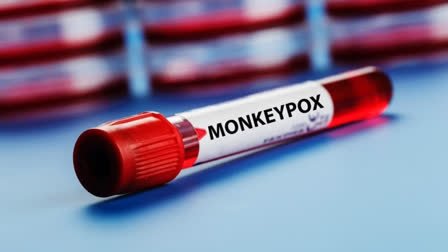 Monkeypox Symptoms