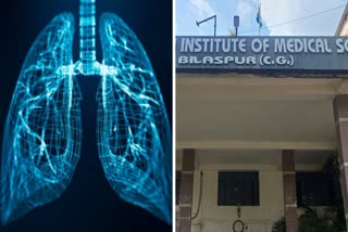Pneumonia patients increased in Bilaspur