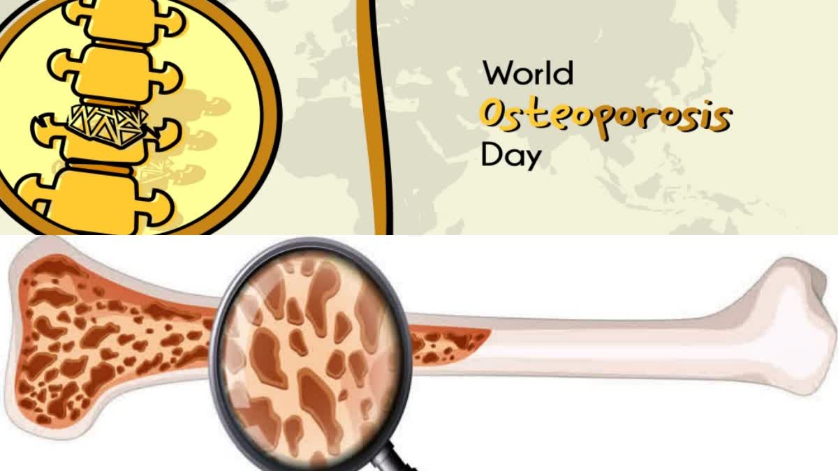 significance history of Osteoporosis Day