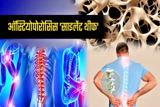 brittle bones is the main focus of World Osteoporosis Day and significance history of Osteoporosis Day