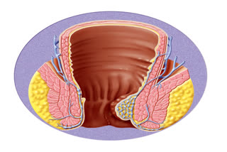 World Piles Day is observed on November 20, every year to raise awareness about hemorrhoids(piles), a collection of inflamed tissue in the anal canal.