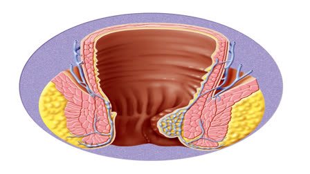 World Piles Day is observed on November 20, every year to raise awareness about hemorrhoids(piles), a collection of inflamed tissue in the anal canal.