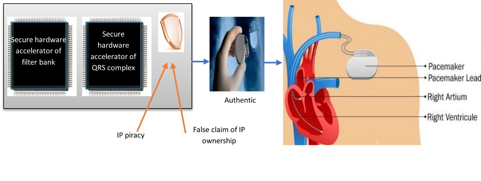 Secure ECG detector design