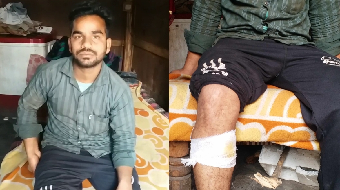 Injured in Haldwani violence