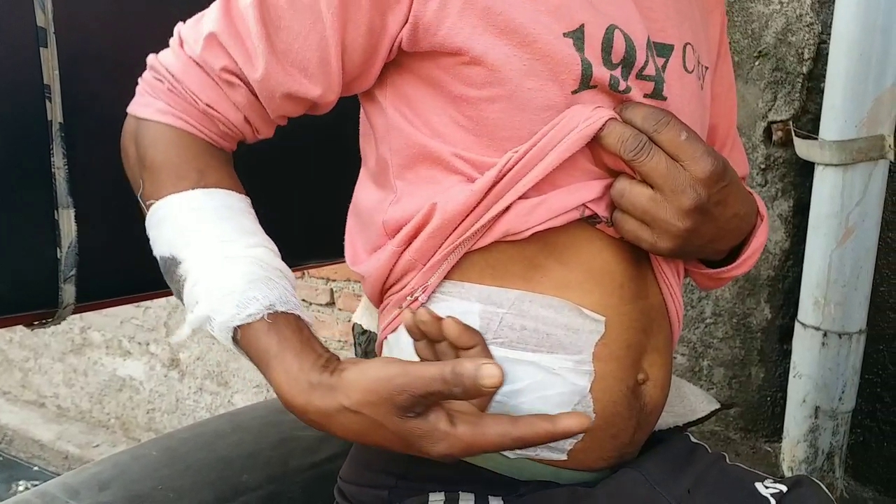 Injured in Haldwani violence