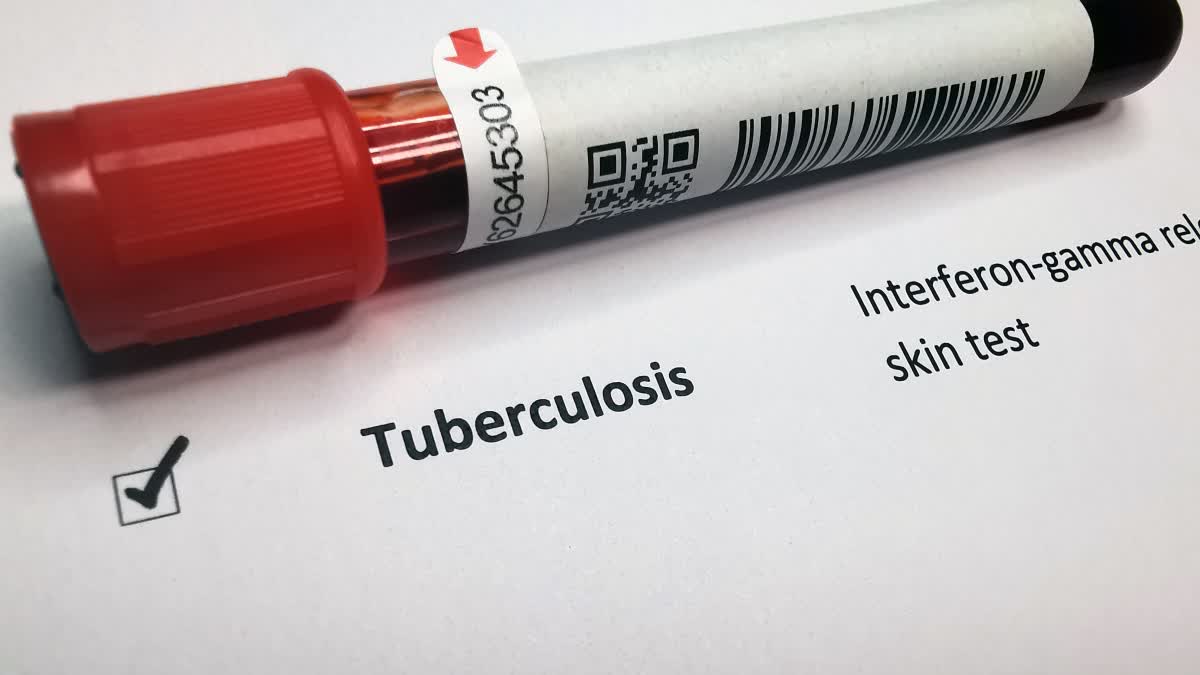 TB DISEASE SYMPTOMS