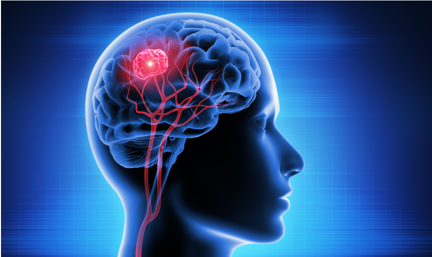 WHAT CAUSES EVERYDAY HEADACHES