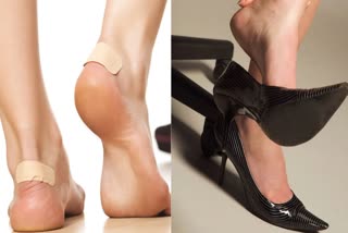 Shoe Bite Remedies