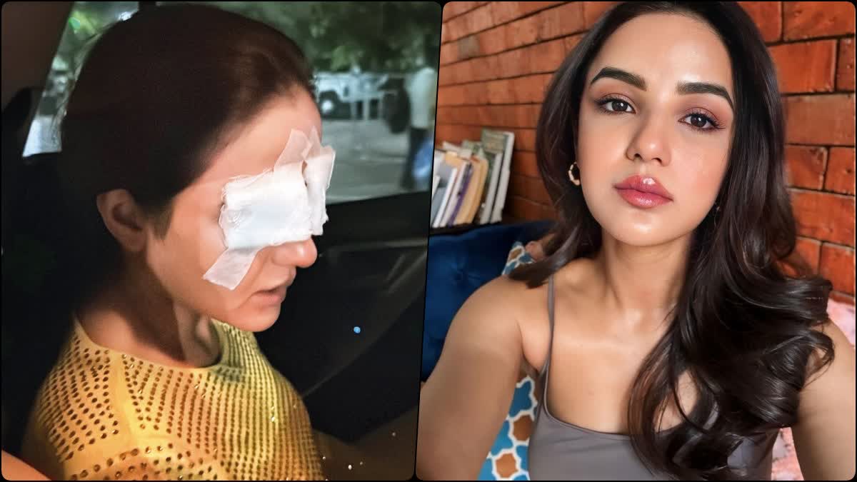 Jasmin Bhasin Cornea Damage