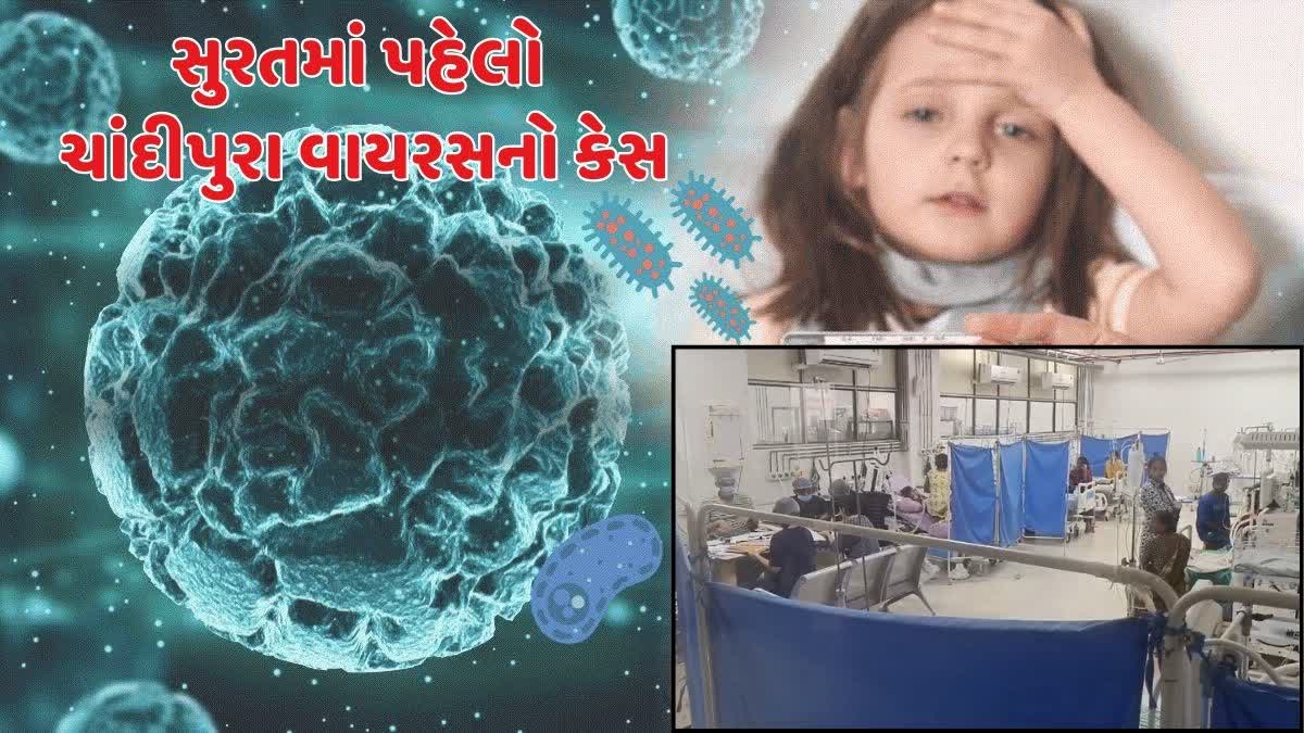 સુરતમાં પહેલો શંકાસ્પદ ચાંદીપુરા વાયરસનો કેસ