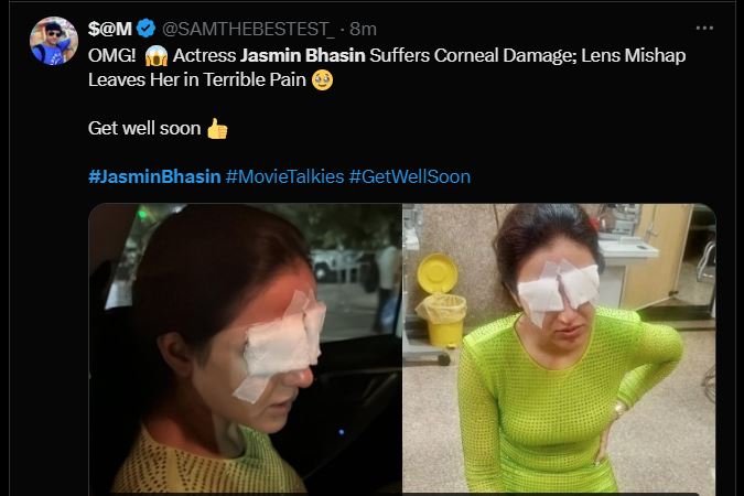 Jasmin Bhasin cornea damaged