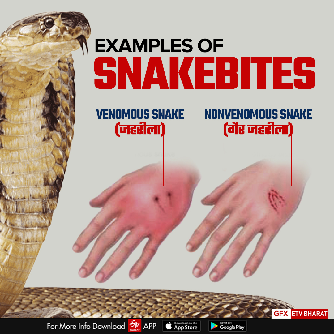 examples of Snake Bite