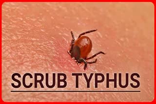 Scrub Typhus In Himachal