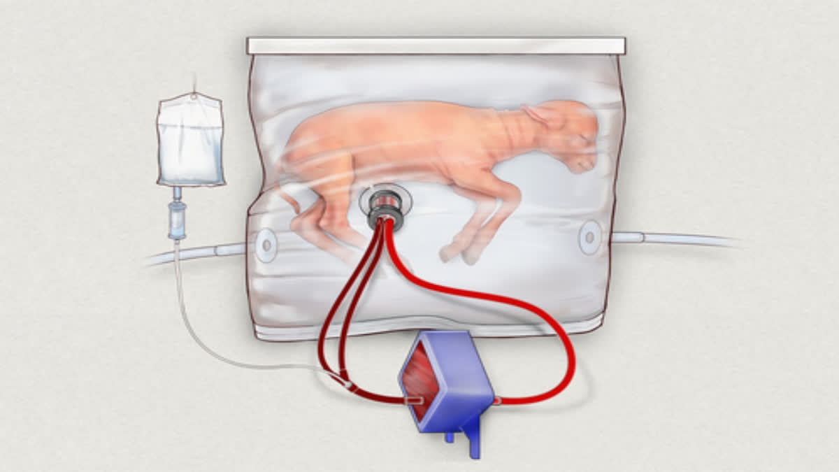 artificial womb experiment seeking FDA approval